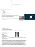 Colles Fracture - Physiopedia