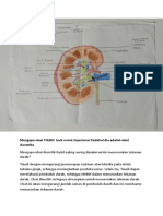 Gambar Ginjal Beserta Alasan Obat Tiazid Digunakan Sebagai Obat Hipertensi Padahal Obat Tersebut Adalah Obat Diuretika