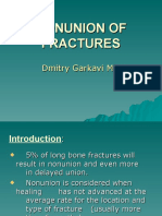 Nonunion of Fractures