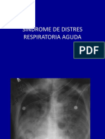 Sindrome de Distres Respiratoria Aguda