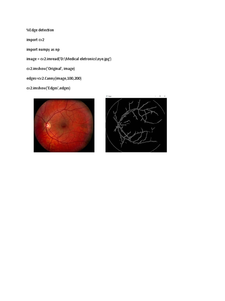 Edge Detection by Python | PDF | Teaching Methods & Materials