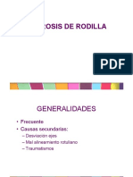 Artrosis de Rodilla