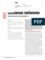 Cutaneous Melanoma
