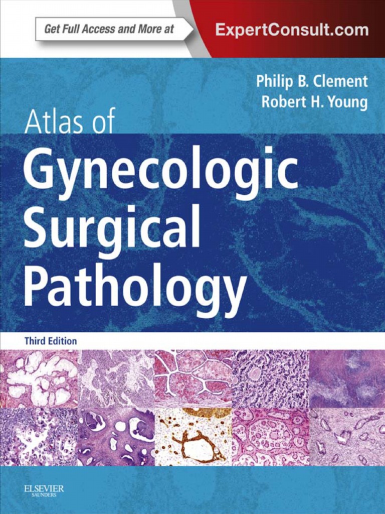 Atlas of Gynecologic Surgical Pathology: Expert Consult