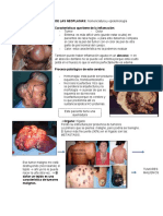 Nomenclatura y Epidemiología de Las Neoplasias