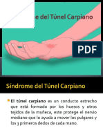 Síndrome del Túnel Carpiano