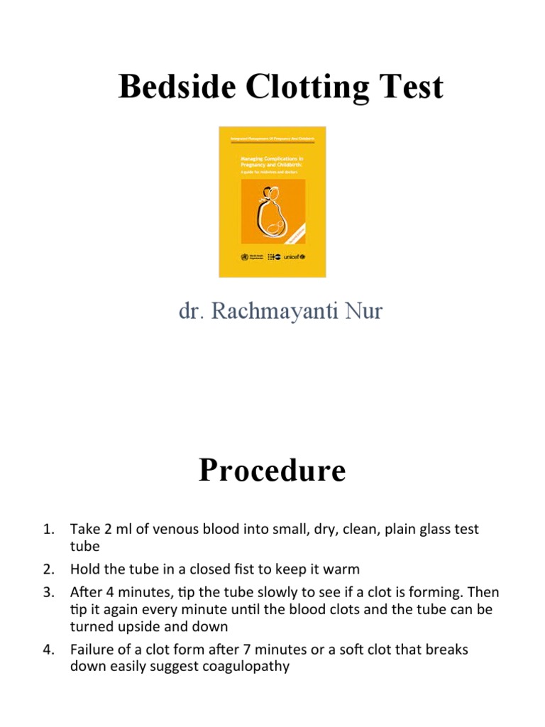 Bedside Clotting TimeAN PDF