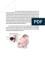 PDF LP Spina Bifida DD