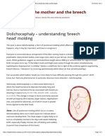 Dolichocephaly - Understanding Breech Head' Molding - The Midwife, The Mother and The Breech