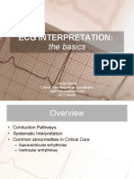 Ecg Interpretation:: The Basics