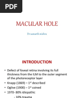 Macular Hole: DR Samarth Mishra