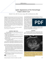 Various Sonographic Appearances of The Hemorrhagic Corpus Luteum Cyst