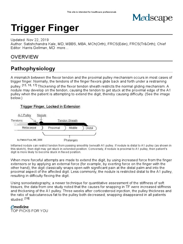 Understanding Trigger Finger Causes | PDF