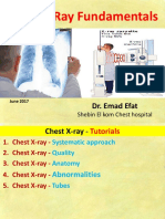 Chest X-Ray Fundamentals: Dr. Emad Efat