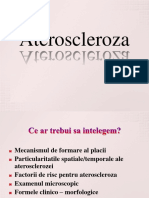 Ateroscleroza