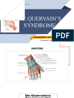 MTE de Quervain Syndrome-Febi Sofiana