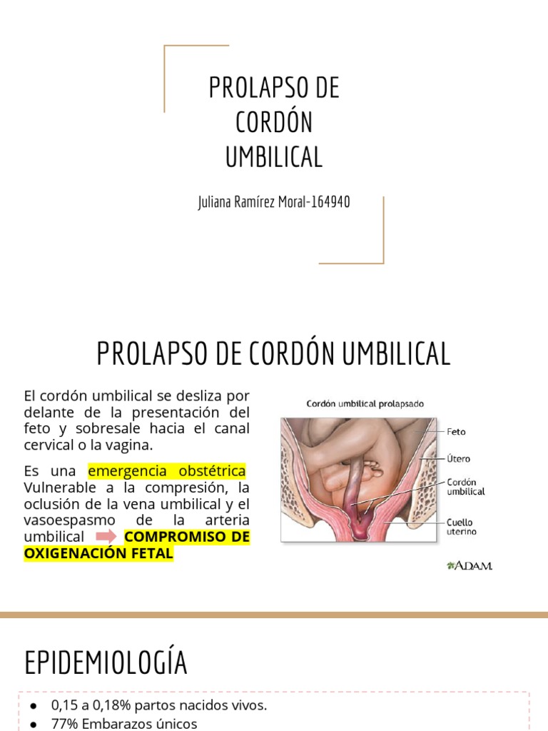 Prolapso de Cordon Umbilical PDF Parto Reanimación cardiopulmonar