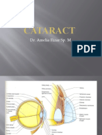 Cataract: Dr. Amelia Rizar Sp. M