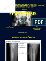 Epifisiolisis en niños: clasificación, diagnóstico y tratamiento