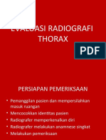EVALUASI RADIOGRAFI thorax