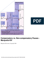Compensatory vs. Non-Compensatory Pauses - Marquette-KH