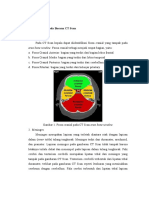 Anatomi Otak Pada Bacaan CT Scan