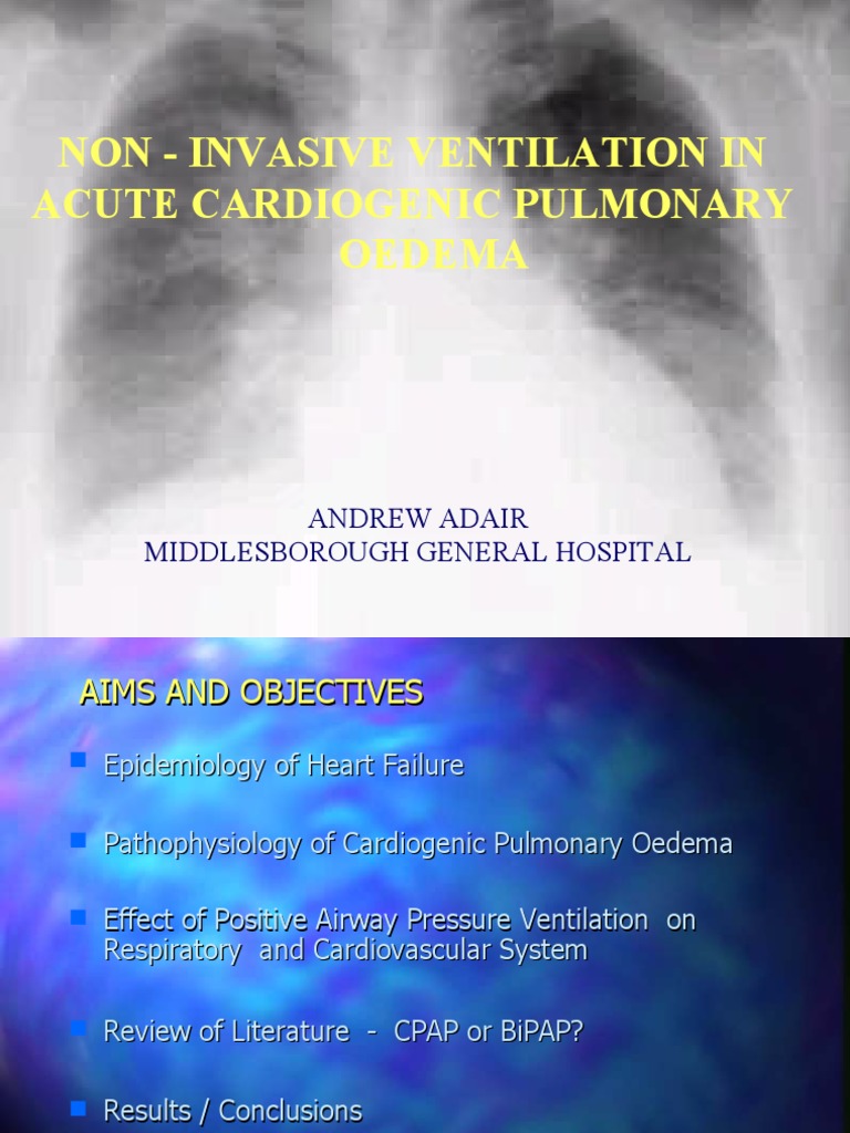 Non - Invasive Ventilation in Acute Cardiogenic Pulmonary Oedema | PDF ...