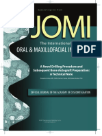 A Novel Drilling Procedure and Subsequent Bone Autograft Preparation: A Technical Note