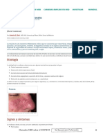 Rosácea - Trastornos Dermatológicos - Manual MSD Versión para Profesionales