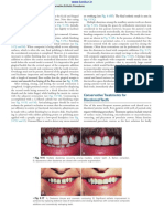 Fig. 9.15P Fig. 9.15Q Fig. 9.16A Fig. 9.15I: Con Ervative Treatment For Di Colored Teeth