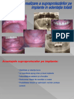 Suprastructura Pe Implante