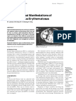 Gastrointestinal Manifestations of Systemic Lupus Erythematosus