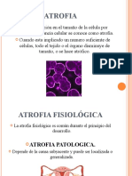 Causas y tipos de atrofia muscular y tejidual