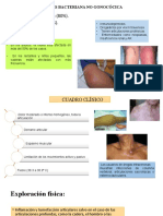 Artritis Bacteriana No Gonocócica