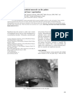 Recurrent Multiple Superficial Mucocele On The Palate: Histopathology and Laser Vaporization