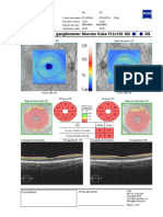 Análisis de Células Ganglionares - Macular Cube 512x128