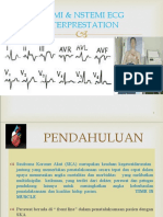 ECG Interpretasi STEMI & NSTEMI