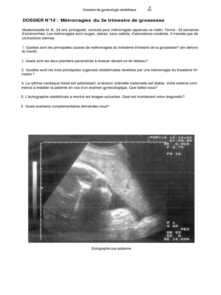 Hémorragies du 3e trimestre de grossesse | PDF | Grossesse | Obstétrique