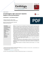 Cardiologia: Arrhythmogenic Right Ventricular Dysplasia: Atypical Clinical Presentation