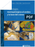 Abordajes de neurocirugia de Álvaro Campero