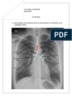 Aporte gráficos de las estructura de la vía aérea normal y su correlación con la radiografía de tórax