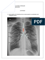 Aporte Gráficos de Las Estructura de La Vía Aérea Normal y Su Correlación Con La Radiografía de Tórax