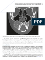 Patologia Oral e Maxilofacial Neville 4 Ed ESTE ES EL QUE USO - 0072