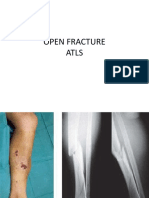 Open Fracture Atls