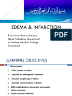 Edema Infarction by Prof. Noor Khan