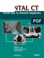 Dental CT_ Third Eye in Dental Implants ( PDFDrive )