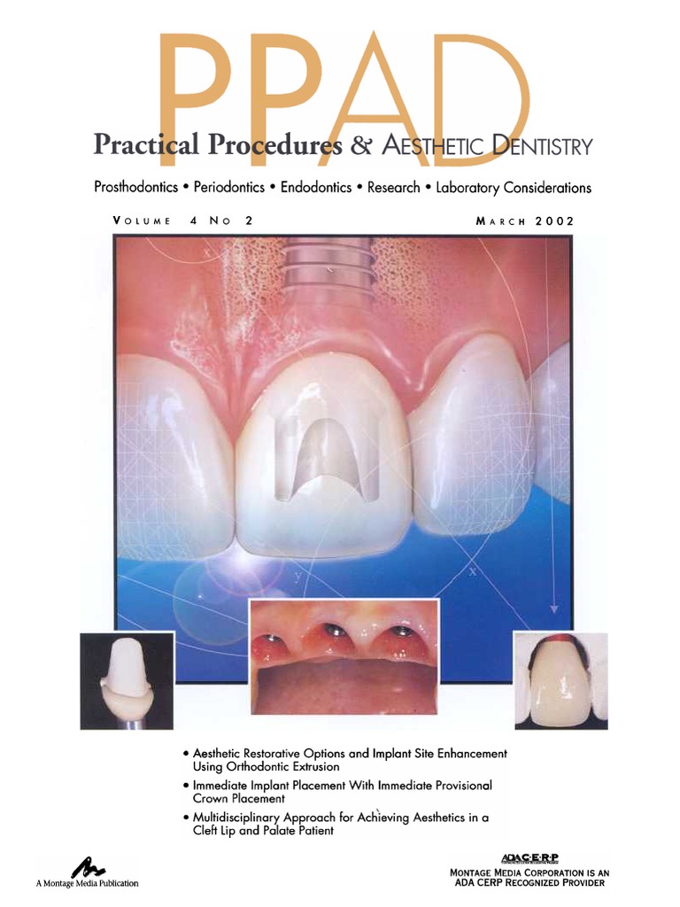 Aesthetic Implant Procedures Overview | PDF | Dental Implant ...