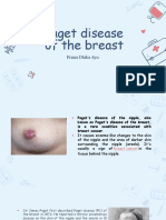 Paget Disease of The Breast Fix