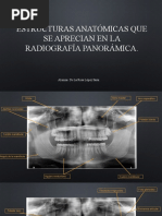 Radiografia Carpal | PDF | Mano | Sistema esquelético