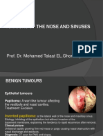 Tumours of The Nose and Sinuses: Prof. Dr. Mohamed Talaat EL - Ghonemy